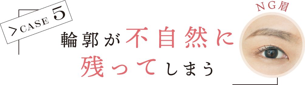 CASE 5 輪郭が不自然に残ってしまう NG眉