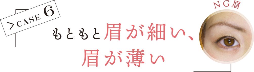 CASE 6 もともと眉が細い、眉が薄い NG眉