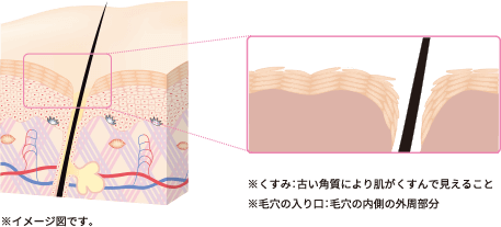 ※イメージ図です。※くすみ:古い角質により肌がくすんで見えること ※毛穴の入り口:毛穴の内側の外周部分