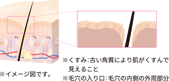 ※イメージ図です。※くすみ:古い角質により肌がくすんで見えること ※毛穴の入り口:毛穴の内側の外周部分